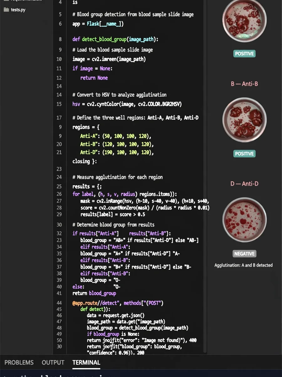Act as a blood grouping detection using image processing — ChatGPT Prompt
